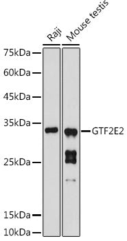 GTF2E2 Rabbit pAb