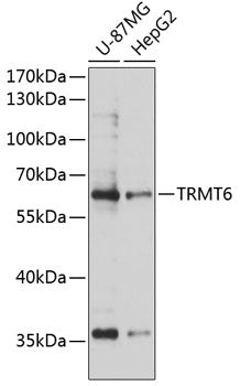 TRMT6 Rabbit pAb