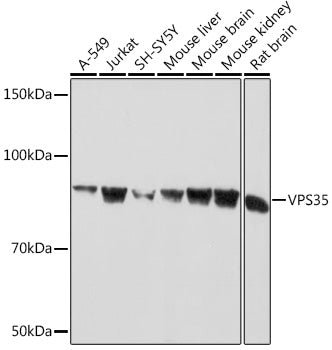 VPS35 Rabbit mAb