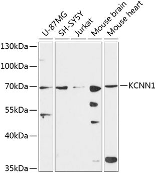 KCNN1 Rabbit pAb