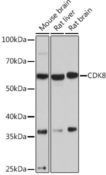 CDK8 Rabbit mAb