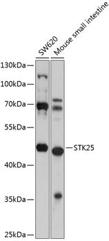 STK25 Rabbit pAb