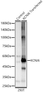 KCNJ6 Rabbit pAb