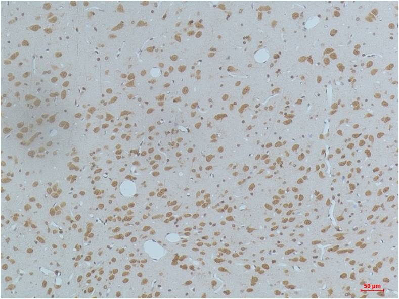 Phospho-CaMKII (Thr287) (3G9) Mouse Monoclonal Antibody
