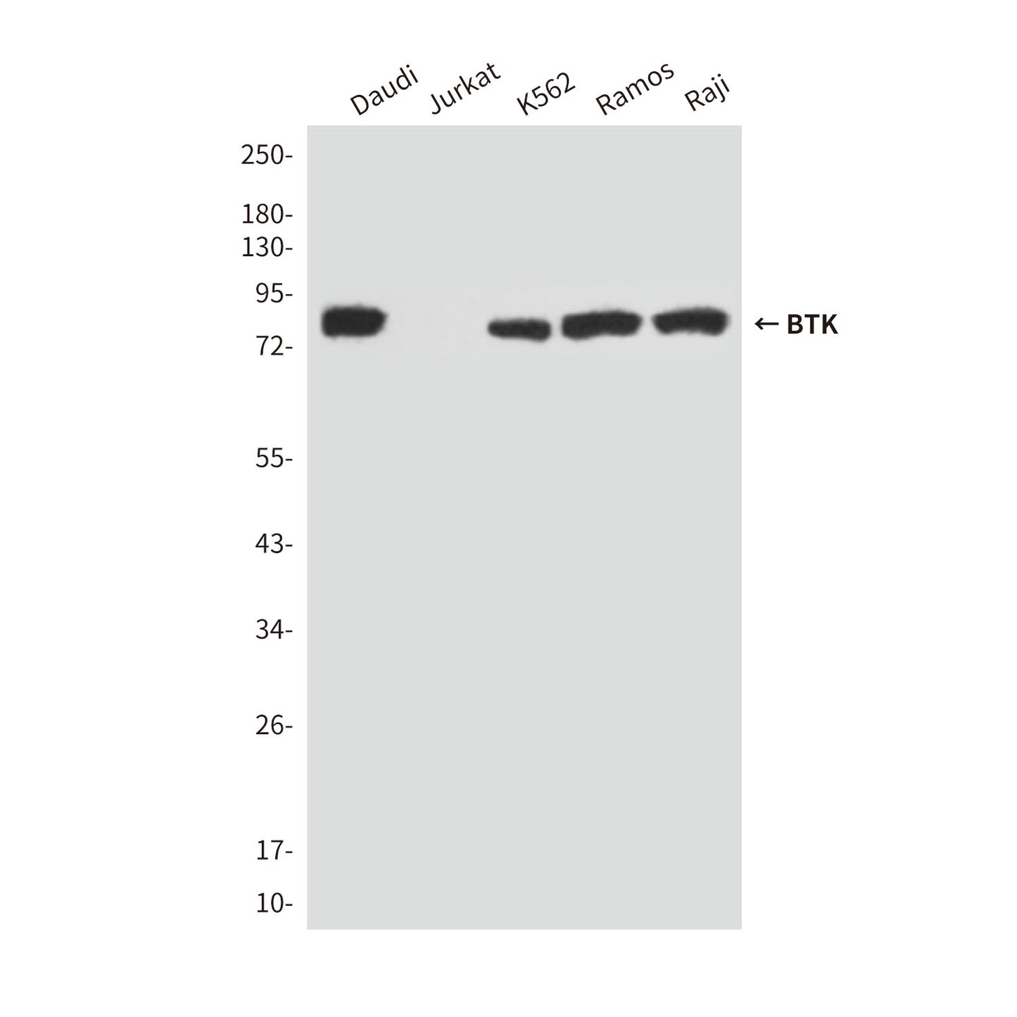 BTK (5B12) Mouse Monoclonal Antibody