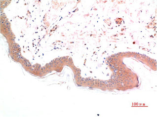 Phospho-Smad3(S425)(1D9)Mouse Monoclonal Antibody