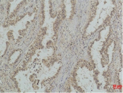P53(Mono Methyl Lys370)(Q59)Mouse Monoclonal Antibody
