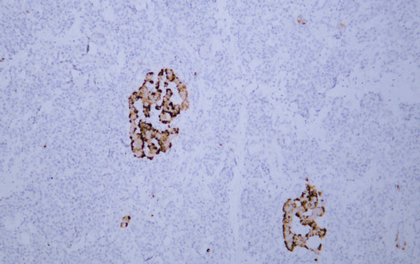 Chromogranin A (ABT037) Mouse Monoclonal Antibody