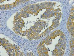 CK19(11F5)Mouse Monoclonal Antibody