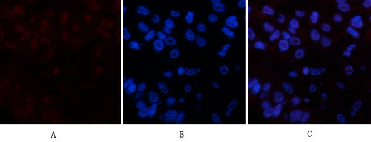 Cleaved PARP(Mix)Mouse Monoclonal Antibody