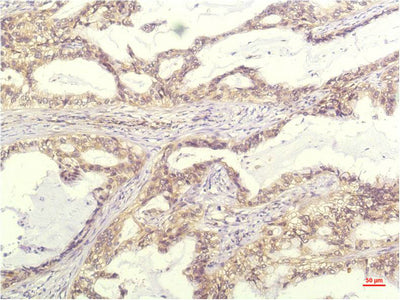 IL-8(13F8)Mouse Monoclonal Antibody