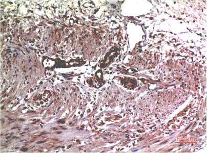 MMP2(1H1)Mouse Monoclonal Antibody