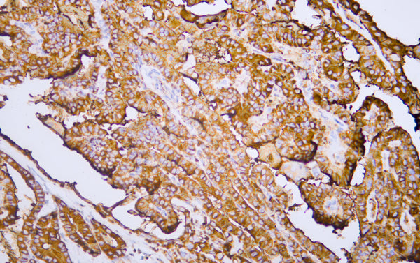 Thyroglobulin(PT0653)Mouse Monoclonal Antibody