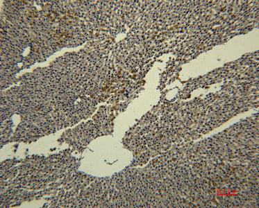 Transferrin(4B4)Mouse Monoclonal Antibody