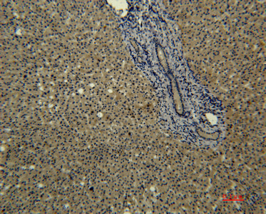 Transferrin(6D6)Mouse Monoclonal Antibody