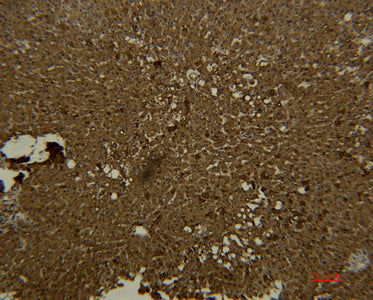 Transferrin(7H11)Mouse Monoclonal Antibody
