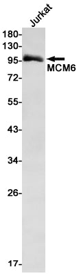 MCM6 Rabbit Monoclonal Antibody