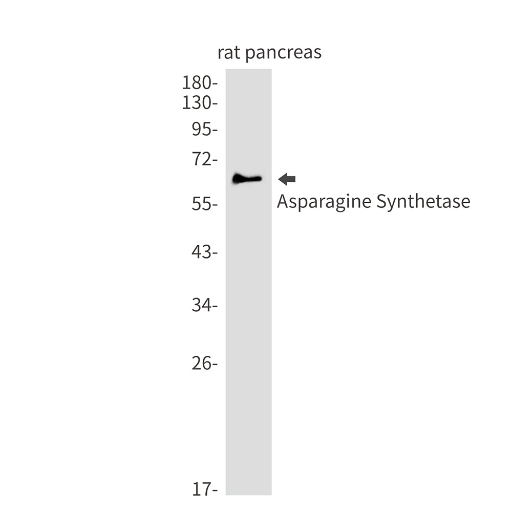 Asparagine Synthetase Rabbit Monoclonal Antibody