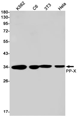 PPP4C Rabbit Monoclonal Antibody