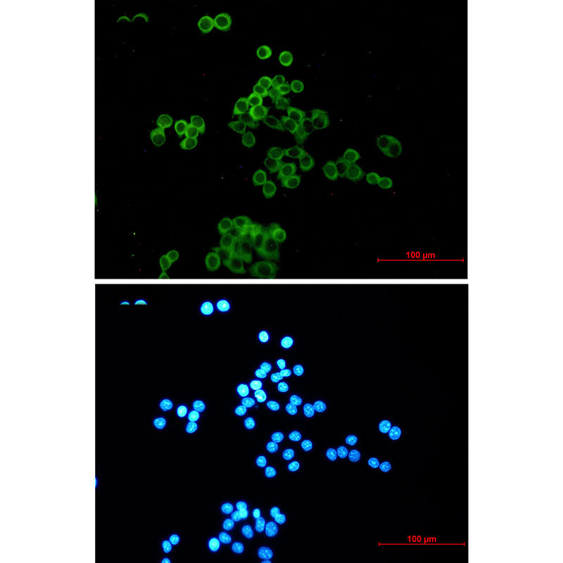 Desmocollin 3 Rabbit Monoclonal Antibody