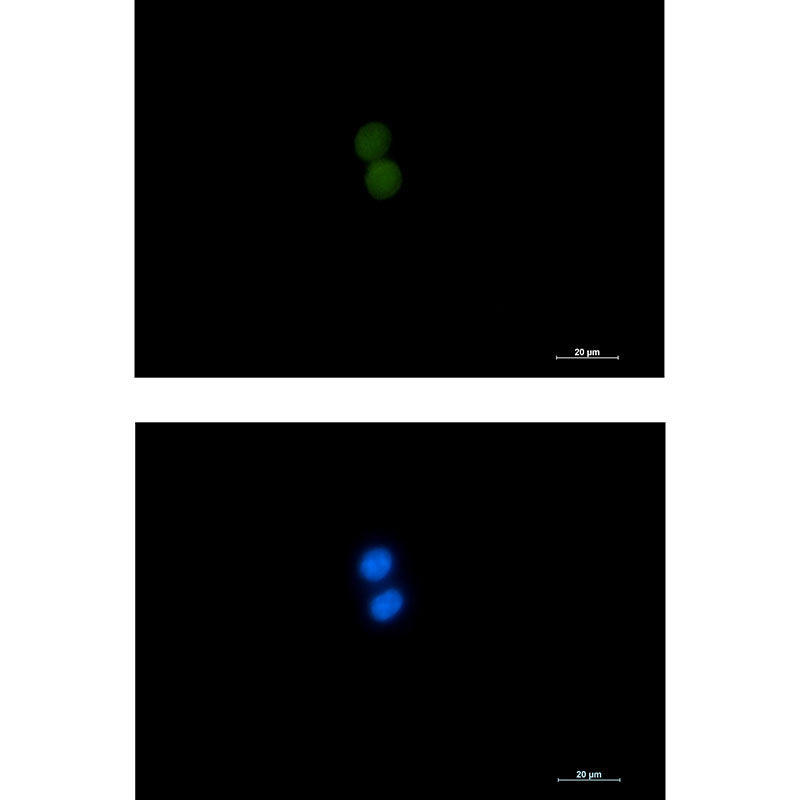 ASH2L Rabbit Monoclonal Antibody