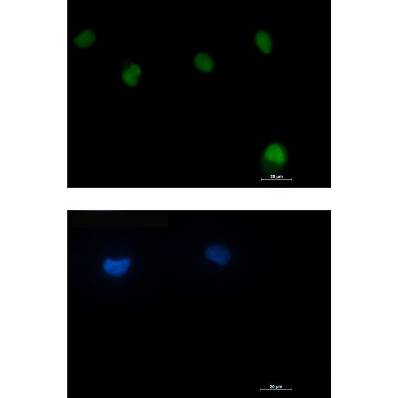 ATM Rabbit Monoclonal Antibody