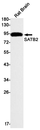 SATB2 Rabbit Monoclonal Antibody