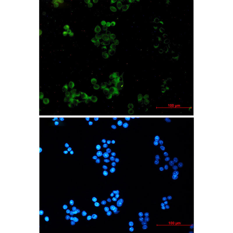 Amyloid Precursor Protein Rabbit Monoclonal Antibody