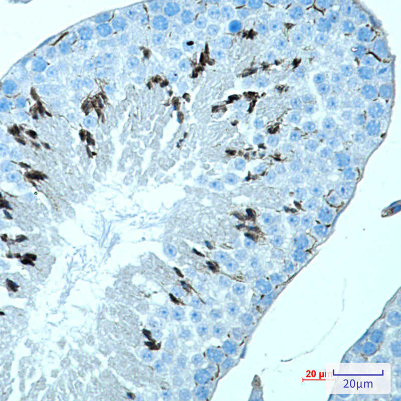 MAGEC2 Rabbit Monoclonal Antibody