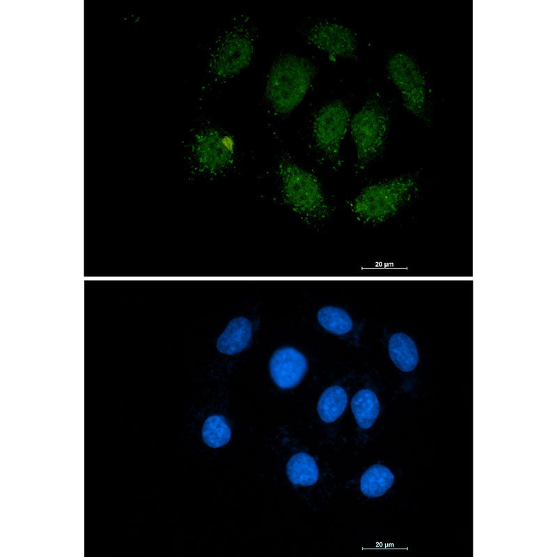 Smad3 Rabbit Monoclonal Antibody