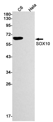 SOX10 Rabbit Monoclonal Antibody