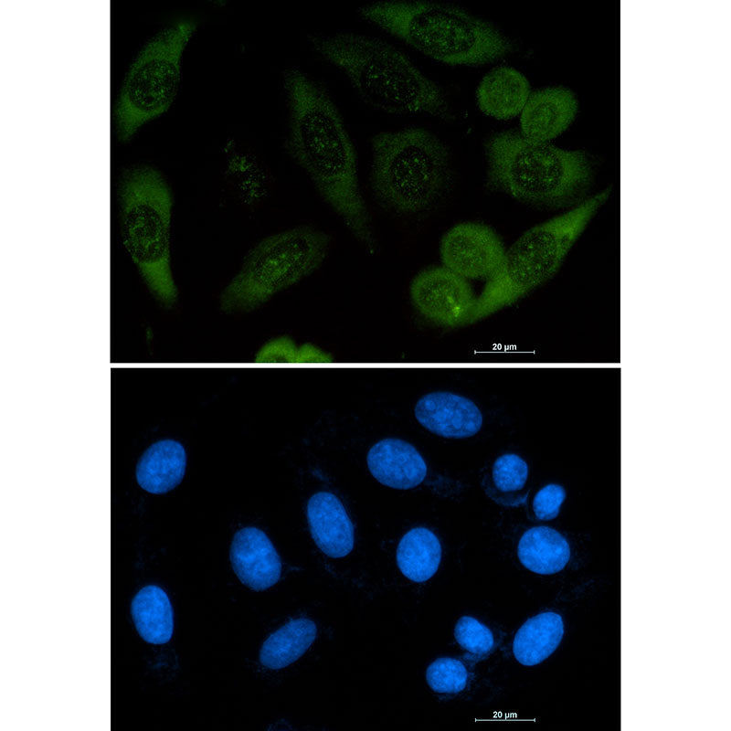 Profilin 1 Rabbit Monoclonal Antibody