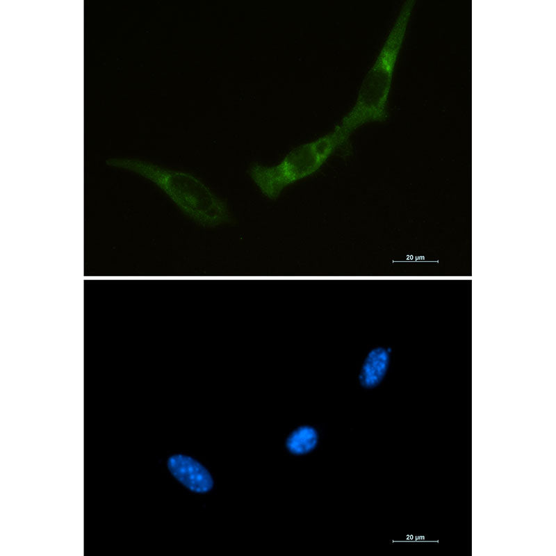 PKR Rabbit Monoclonal Antibody