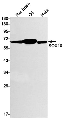 SOX10 Rabbit Monoclonal Antibody