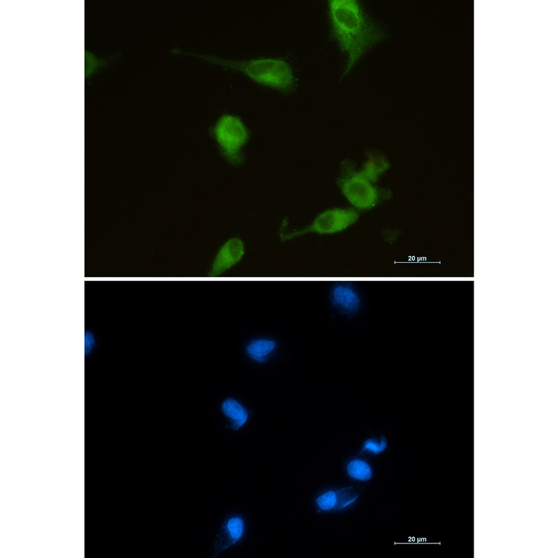 Heme Oxygenase 1 Rabbit Monoclonal Antibody