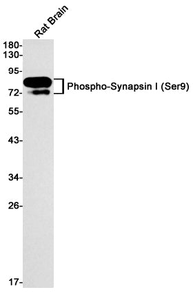 Phospho-Synapsin I (Ser9) Rabbit Monoclonal Antibody