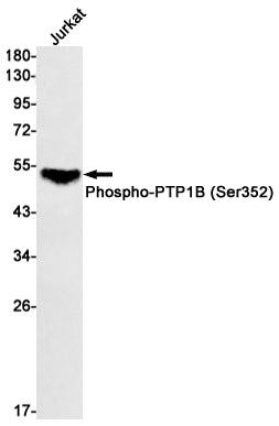 Phospho-PTP1B (Ser352) Rabbit Monoclonal Antibody