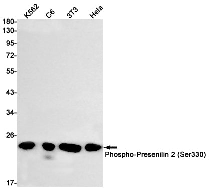 Phospho-Presenilin 2 (Ser330) Rabbit Monoclonal Antibody