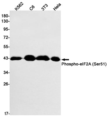 Phospho-eIF2A (Ser51) Rabbit Monoclonal Antibody