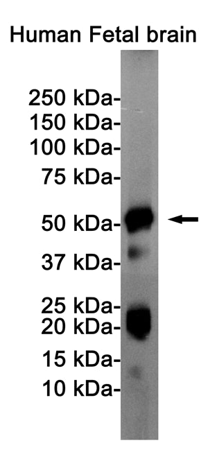 Phospho-Tau (Ser404) Rabbit Monoclonal Antibody
