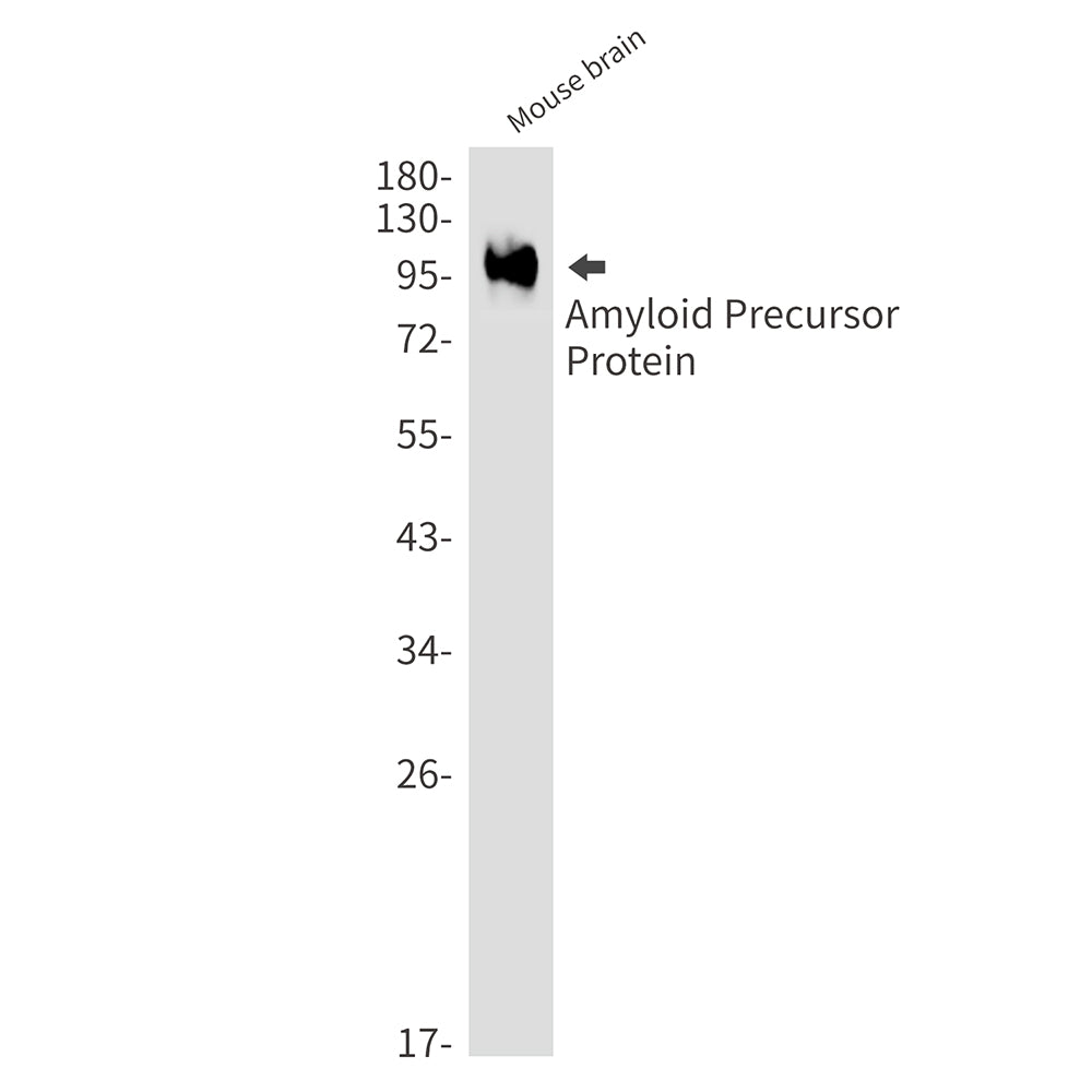 Amyloid Precursor Protein Rabbit Monoclonal Antibody