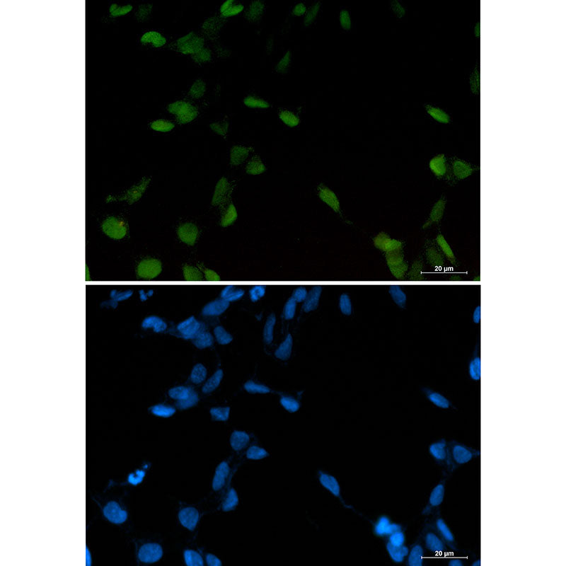 c-Jun Rabbit Monoclonal Antibody