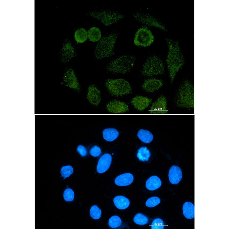 ATF2 Rabbit Monoclonal Antibody