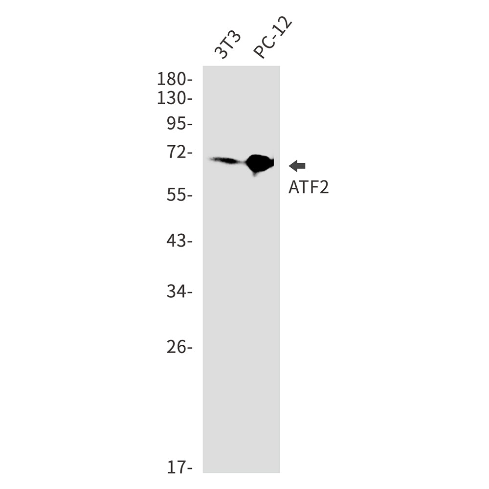 ATF2 Rabbit Monoclonal Antibody