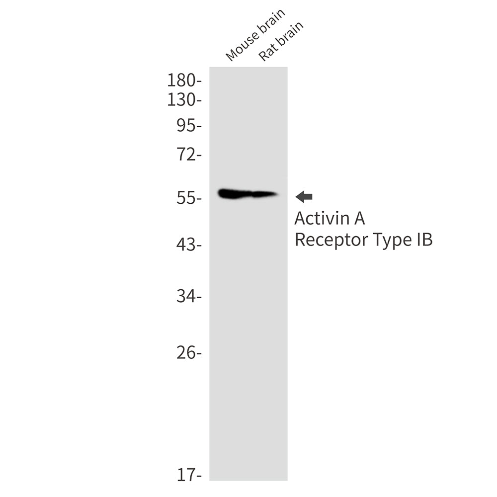 Activin A Receptor Type IB Rabbit Monoclonal Antibody