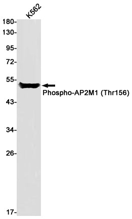 Phospho-AP2M1 (Thr156) Rabbit Monoclonal Antibody