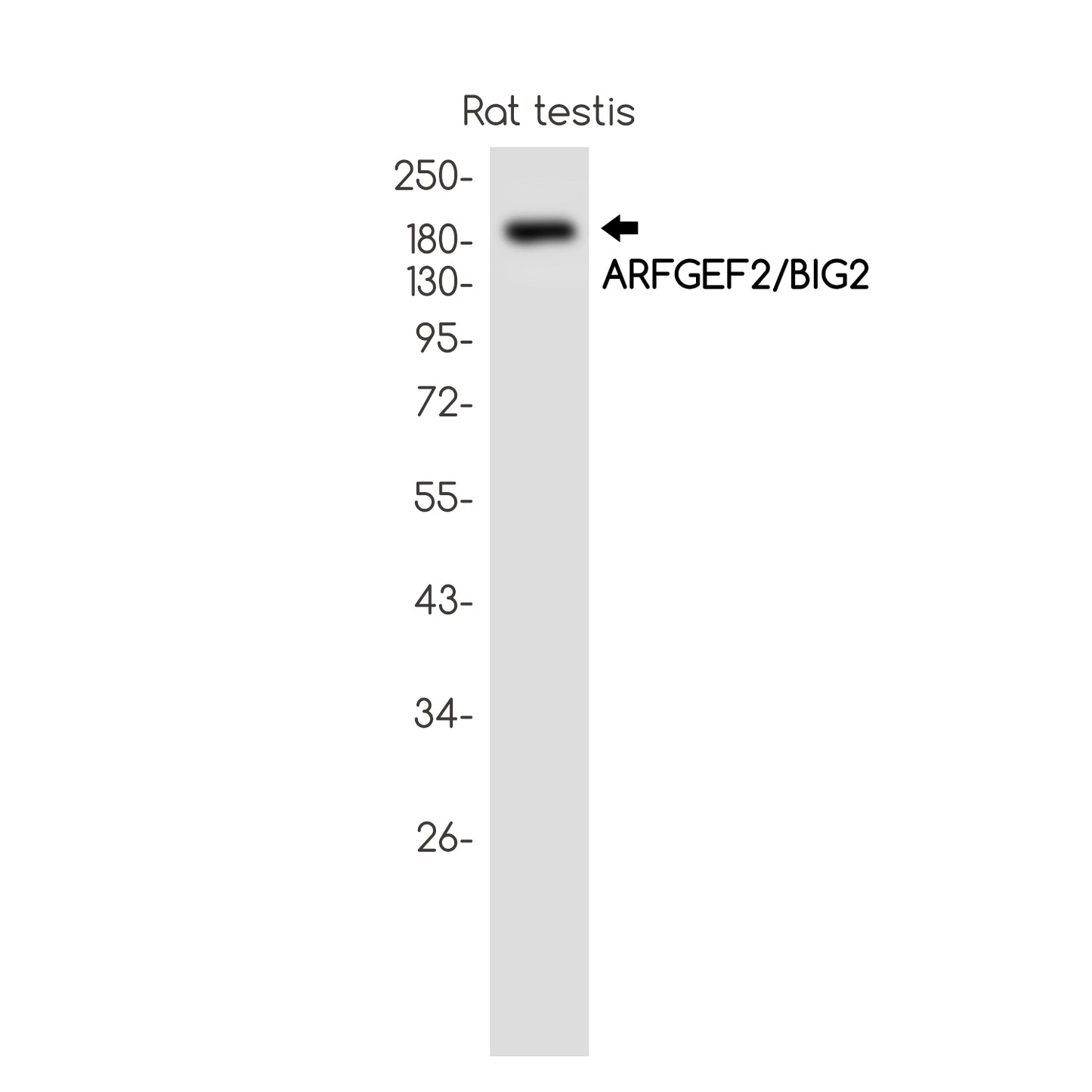 ARFGEF2 Rabbit Monoclonal Antibody