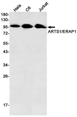 ERAP1 Rabbit Monoclonal Antibody