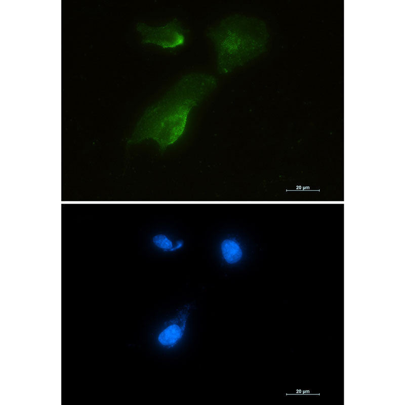Aspartate Aminotransferase Rabbit Monoclonal Antibody