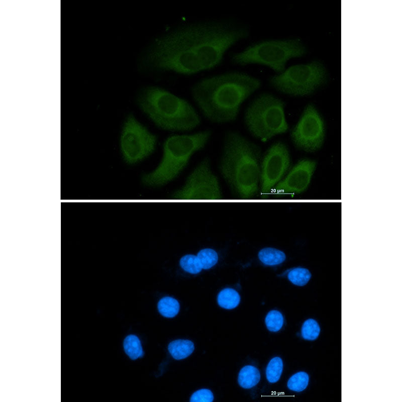 ATP Citrate lyase Rabbit Monoclonal Antibody